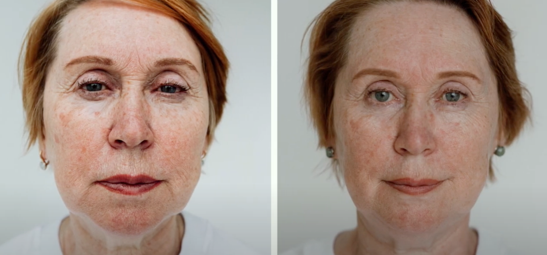 Japanese Forlle'd cosmetics and its effect - project "before and after"