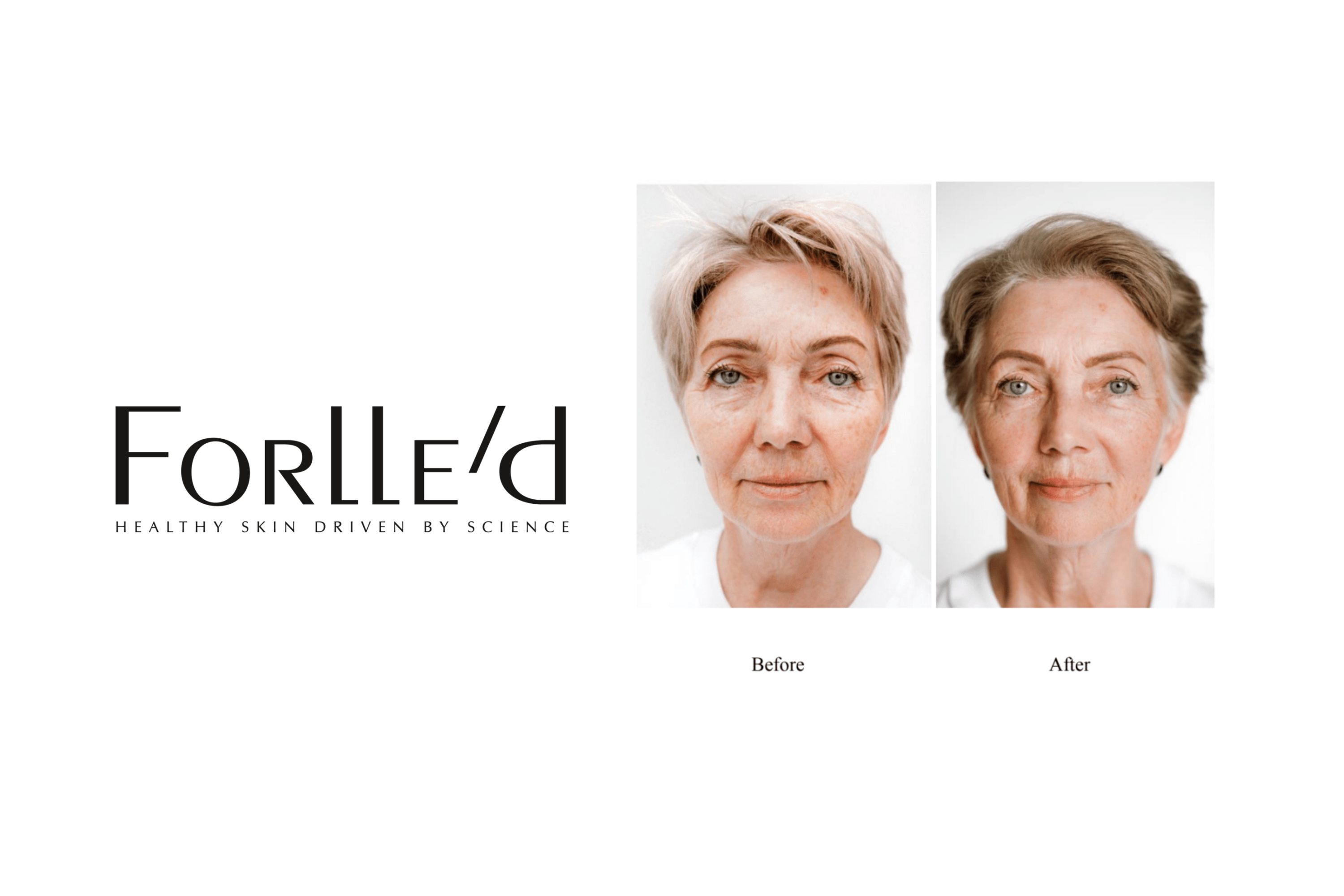 Kodėl brangi kosmetika veikia