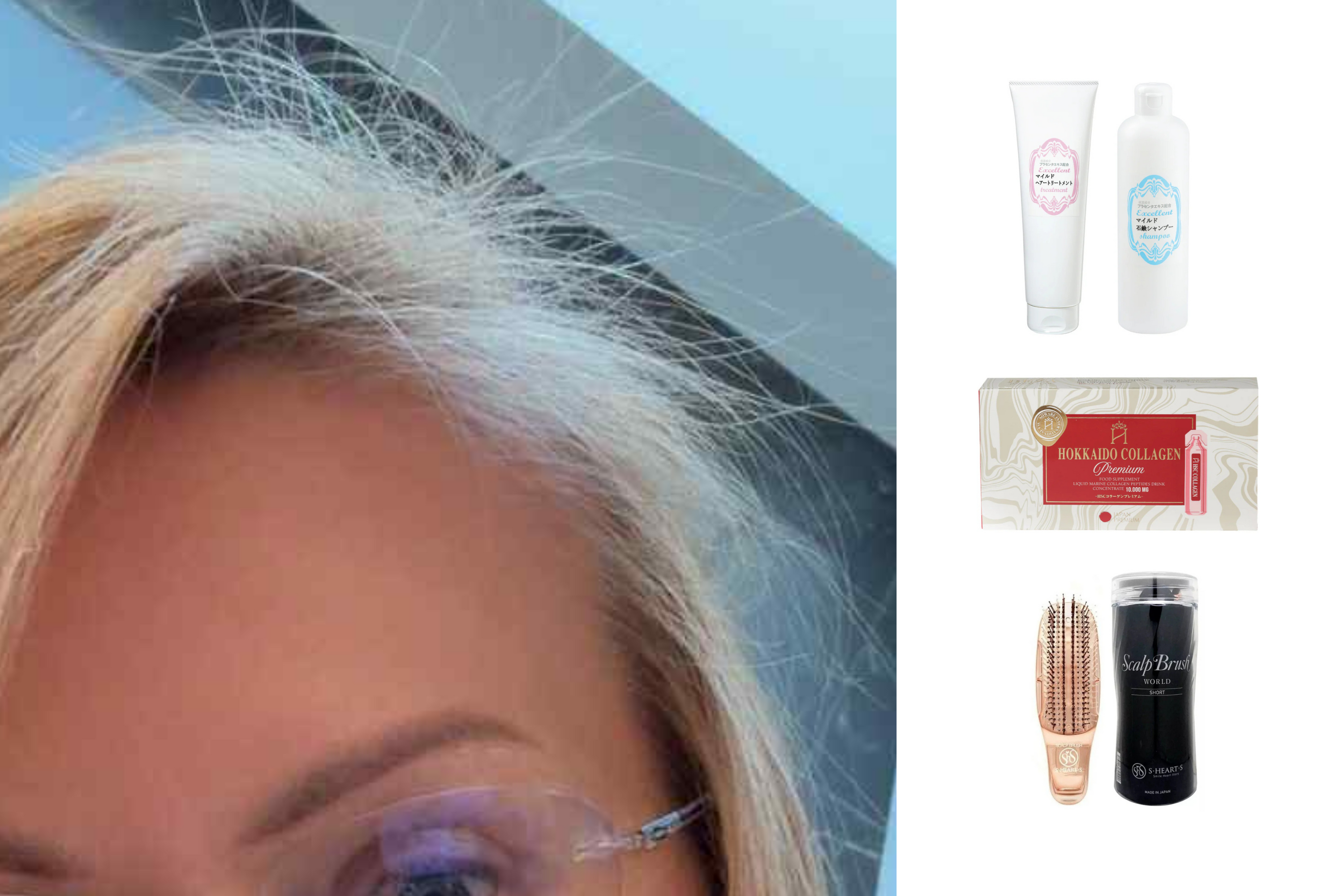 Ar gali plaukai ataugti, kai jau galvojai, kad viskas – beviltiška?