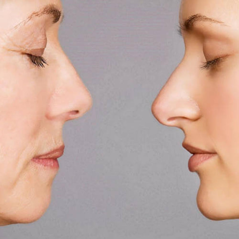 Anti-aging