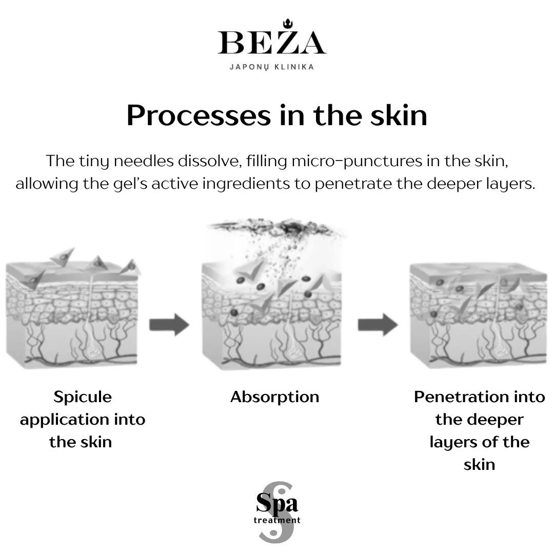 Loose Spicular deimanto formos dalelytės (adatėlės)  2,3 g Japonų Klinika - Beža