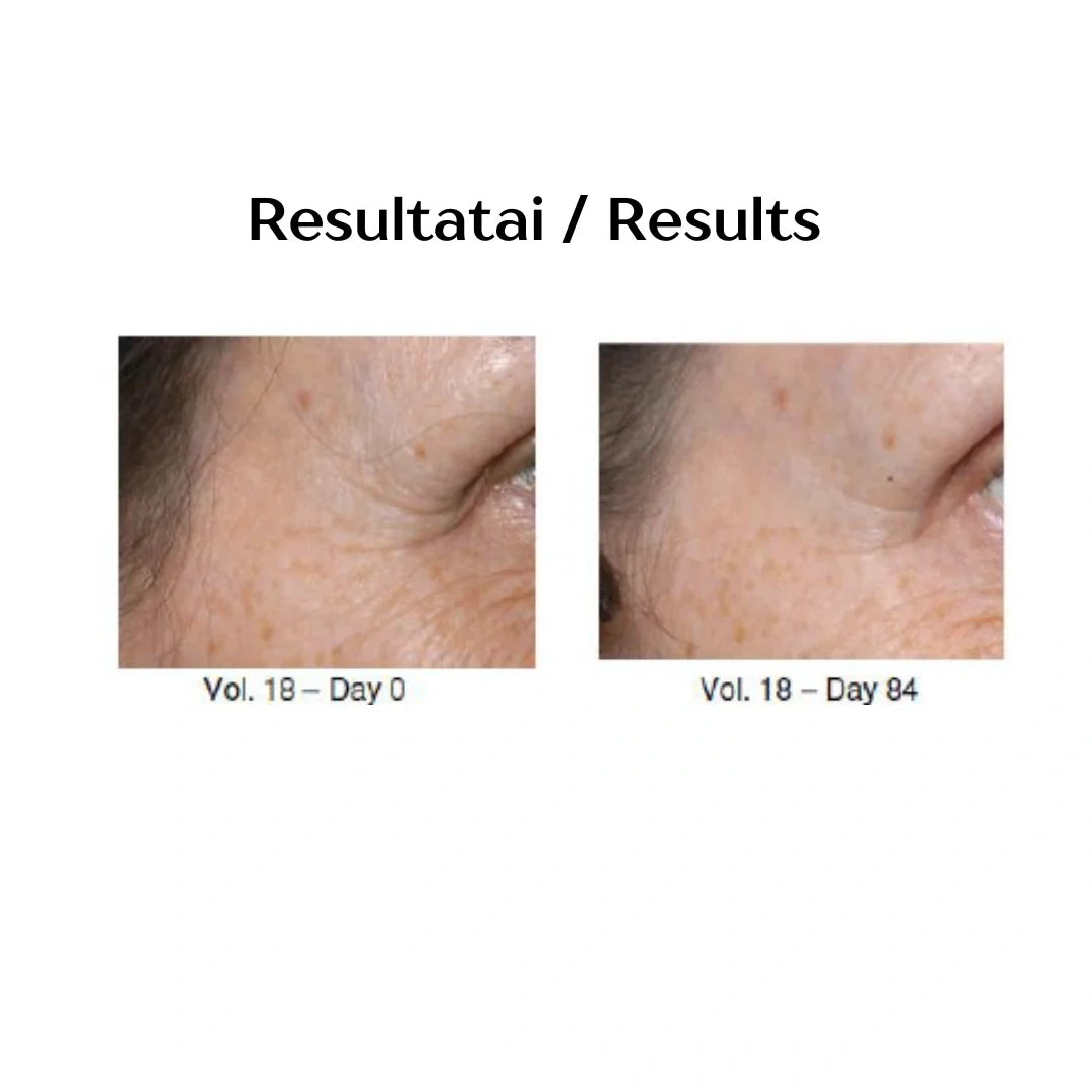 SPA TREATMENT LUXE EYE CREAM. Restorative eye cream with peptides and ceramides, 25 g